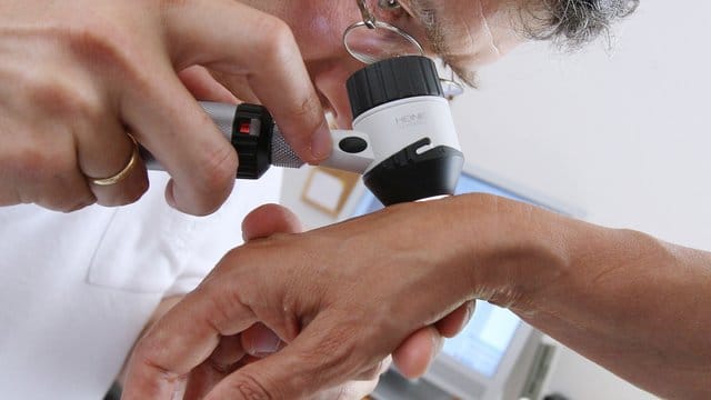 Laut einer Erhebung ist die Zahl der Hautkrebserkrankungen in den letzten Jahren stark gestiegen. Laut einer Erhebung ist die Zahl der Hautkrebserkrankungen in den letzten Jahren stark gestiegen.