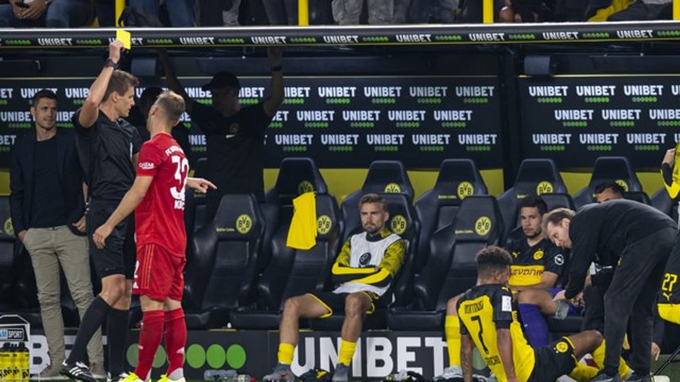Gut bedient: Bayerns Joshua Kimmich sieht Gelb.