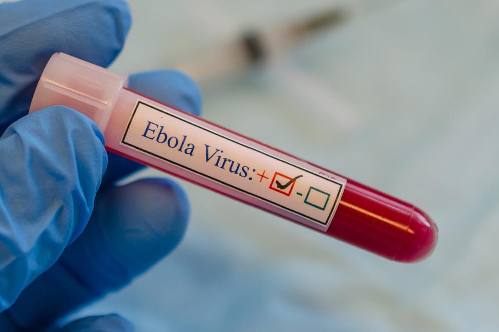 Eine positiv auf Ebola getestete Blutprobe: Zwei neue Medikamente können die Ausbreitung des Virus im Körper verhindern.