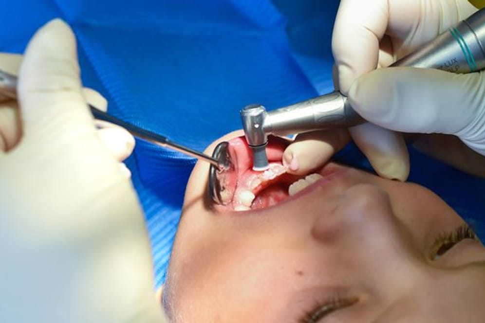 Bei Verdacht auf Kreidezähne sollten Eltern mit dem Kind einen Zahnarzt aufsuchen.
