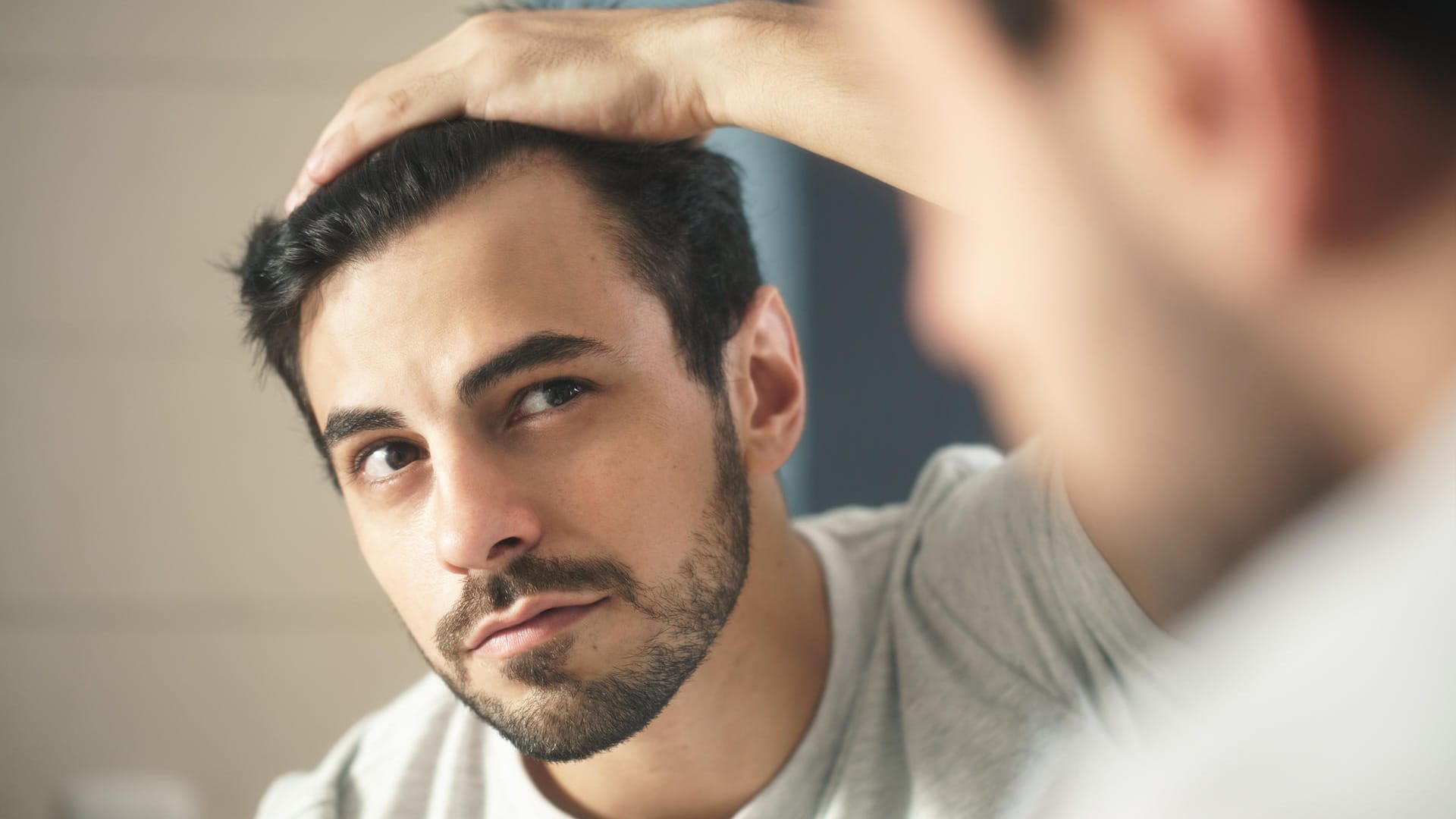 Haarausfall beim Mann ist ein schleichender Prozess. Er beginnt meist mit dünner werdendem Haar und lichten Stellen am Ansatz.