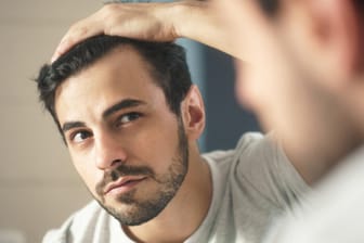 Haarausfall beim Mann ist ein schleichender Prozess. Er beginnt meist mit dünner werdendem Haar und lichten Stellen am Ansatz.