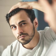 Haarausfall beim Mann ist ein schleichender Prozess. Er beginnt meist mit dünner werdendem Haar und lichten Stellen am Ansatz.