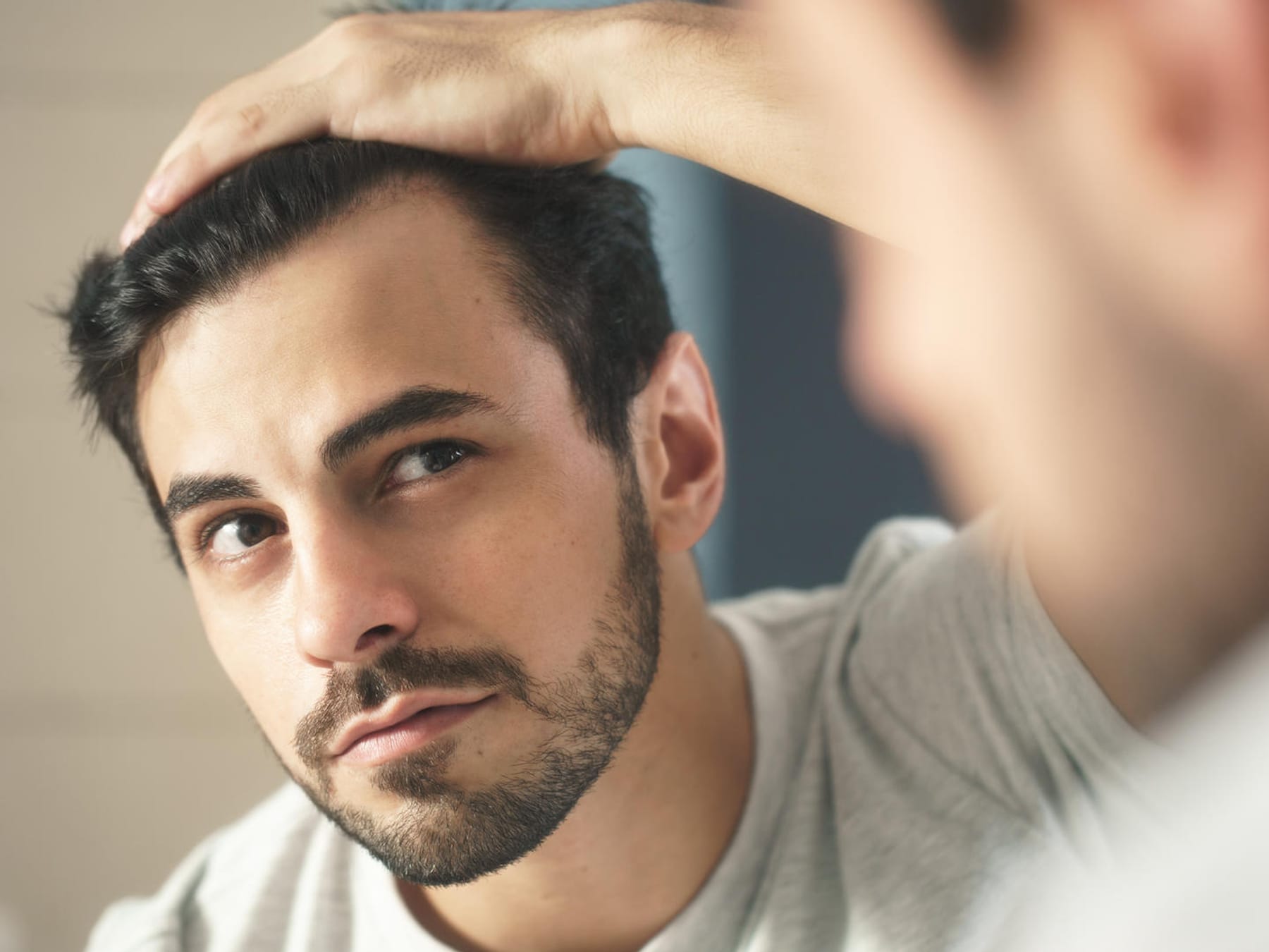 Haarausfall bei Männern stoppen: Welche Mittel helfen? Ursachen & Tipps