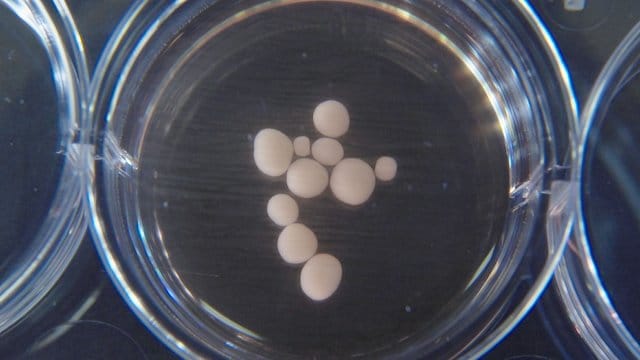 Dieses computergesteuerte Bild zeigt erbsengroße Gehirnorganoide im Alter von 10 Monaten. Dieses computergesteuerte Bild zeigt erbsengroße Gehirnorganoide im Alter von 10 Monaten.