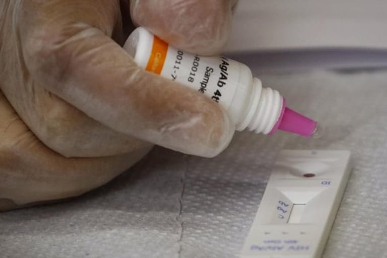 Ein Fachmann führt einen HIV-Test durch.