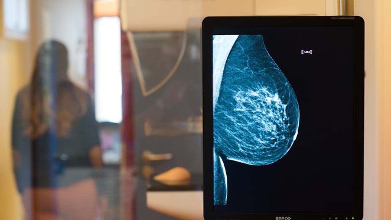 Für Frauen im Alter von mehr als 75 Jahren und einer chronischen Krankheit, wie Diabetes oder einer Herz-Kreislauf-Erkrankung, bringt ein Mammografie-Screening kaum einen Nutzen.