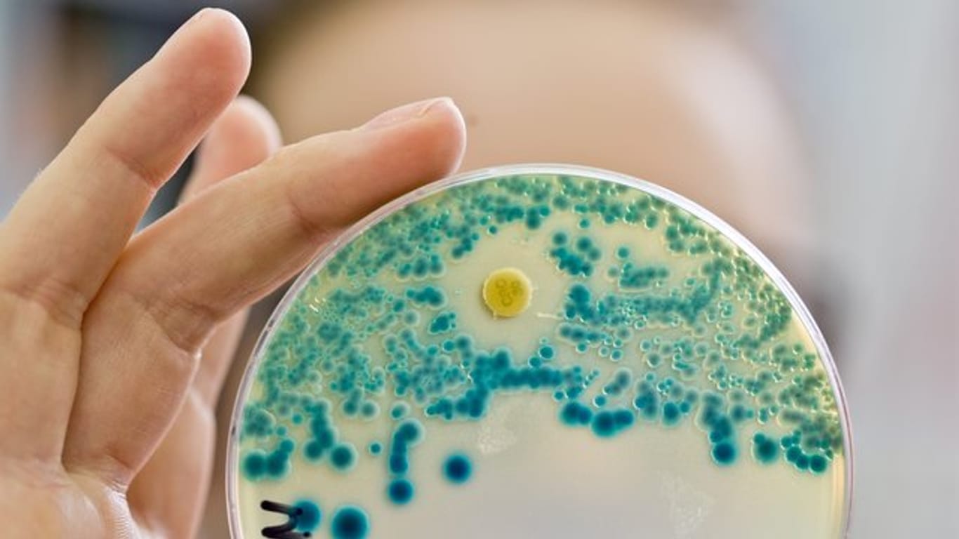 Eine Labormitarbeiterin des Universitätsklinikums Erlangen hält eine Indikatorkulturplatte zum Nachweis von resistenten Bakterien.