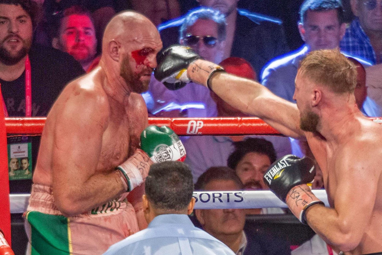 Blutige Angelegenheit: Tyson Fury (l.) musste im Kampf gegen Otto Wallin teilweise empfindliche Treffer einstecken.