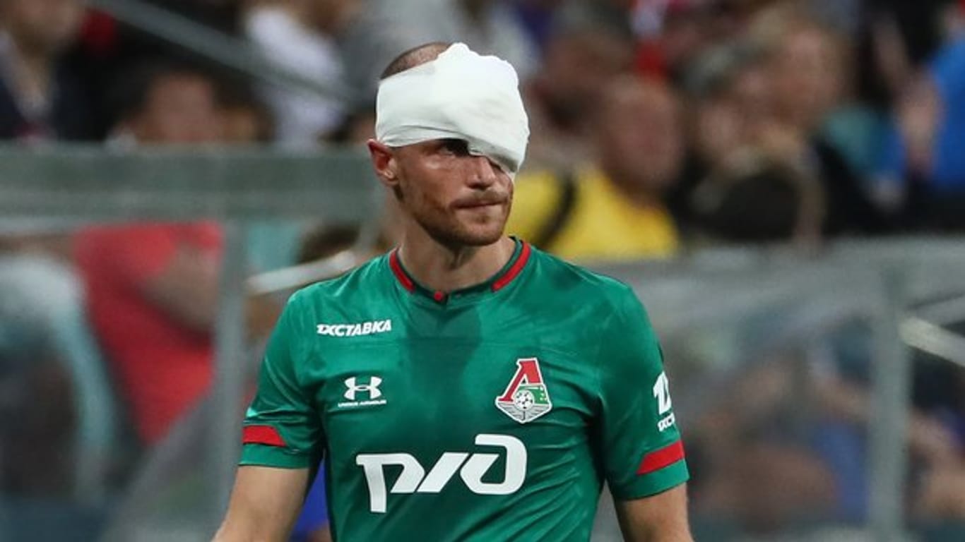 Benedikt Höwedes hatte sich in Sotschi eine Platzwunde über dem linken Auge zugezogen.