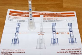 Die Utensilien für einen HIV-Selbsttest liegen auf einem Tisch.