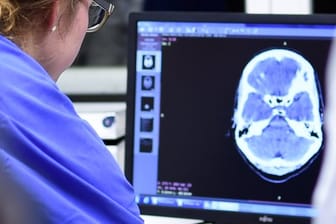 Eine Medizinstudentin sieht sich in einer Klinik bei einer Übung eine Computertomographie an.