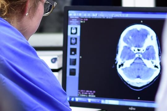 Eine Medizinstudentin sieht sich in einer Klinik bei einer Übung eine Computertomographie an.