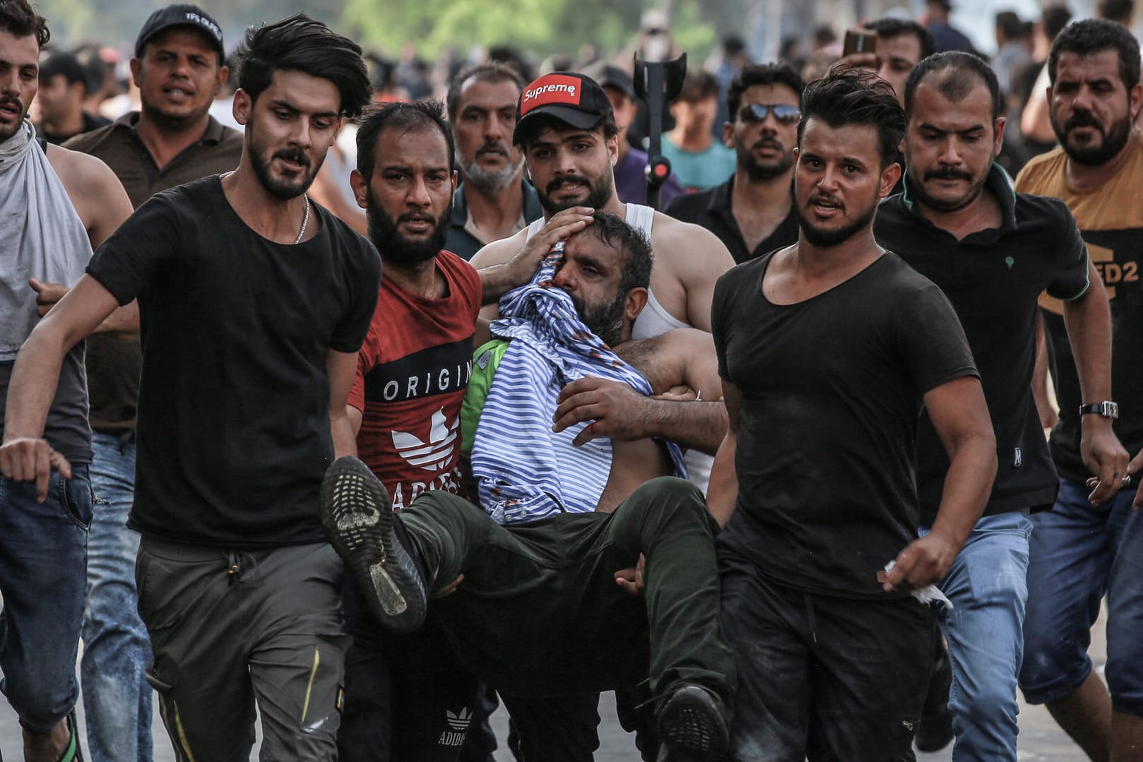 Demonstranten mit Verletztem im Irak: Die UN fordert ein Ende der Gewalt.