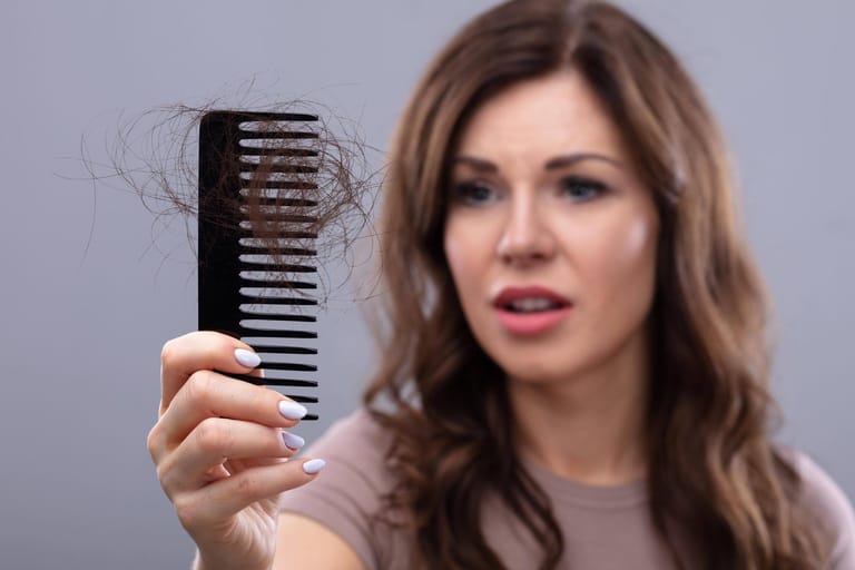 Ein Kamm mit Haarbüschel: Haarausfall muss nicht immer genetisch bedingt sein – auch Stress oder Hormonschwankungen können ein Grund sein.
