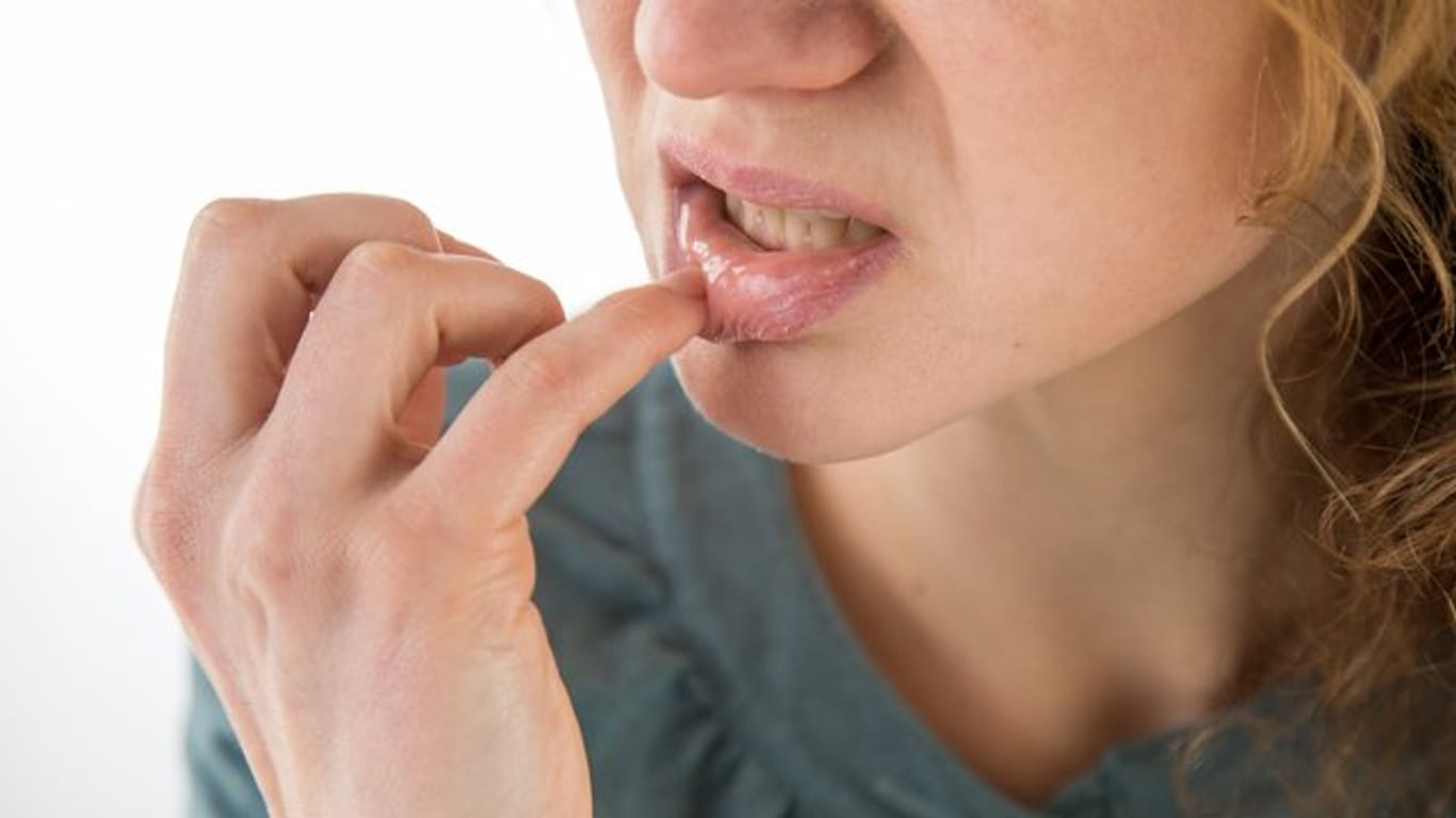 Wer häufig mit sogenannten Aphthen zu kämpfen hat, sollte besonders auf Mundhygiene achten.