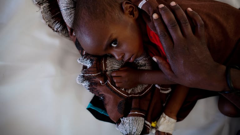 Wegen einer Dürre in Äthiopien hat die Familie von Abdi (20 Monate) ihr Vieh verloren und sucht im benachbarten Somalia Hilfe.