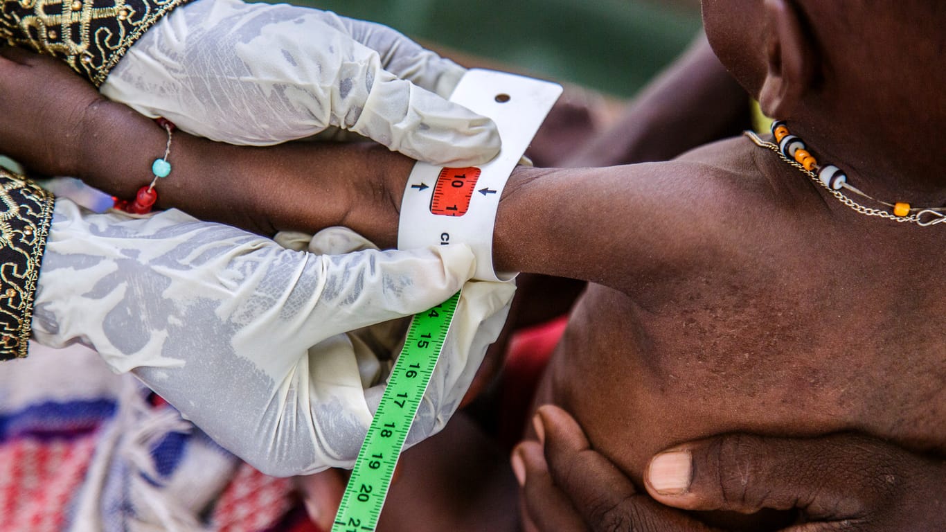 In einem von Unicef unterstützen Gesundheitszentrum im Nordosten Nigerias wird der Umfang des Oberarms der mangelernährten Fanne Saleh (1 Jahr) gemessen.