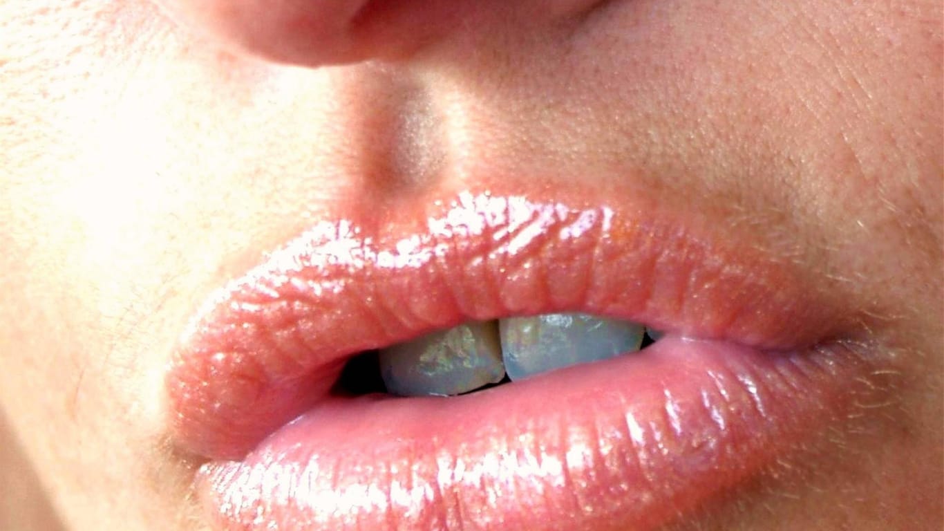 Aufgespritzte Lippen (Symbolbild): In Bochum hat eine Influencerin illegal Schönheitseingriffe vorgenommen.