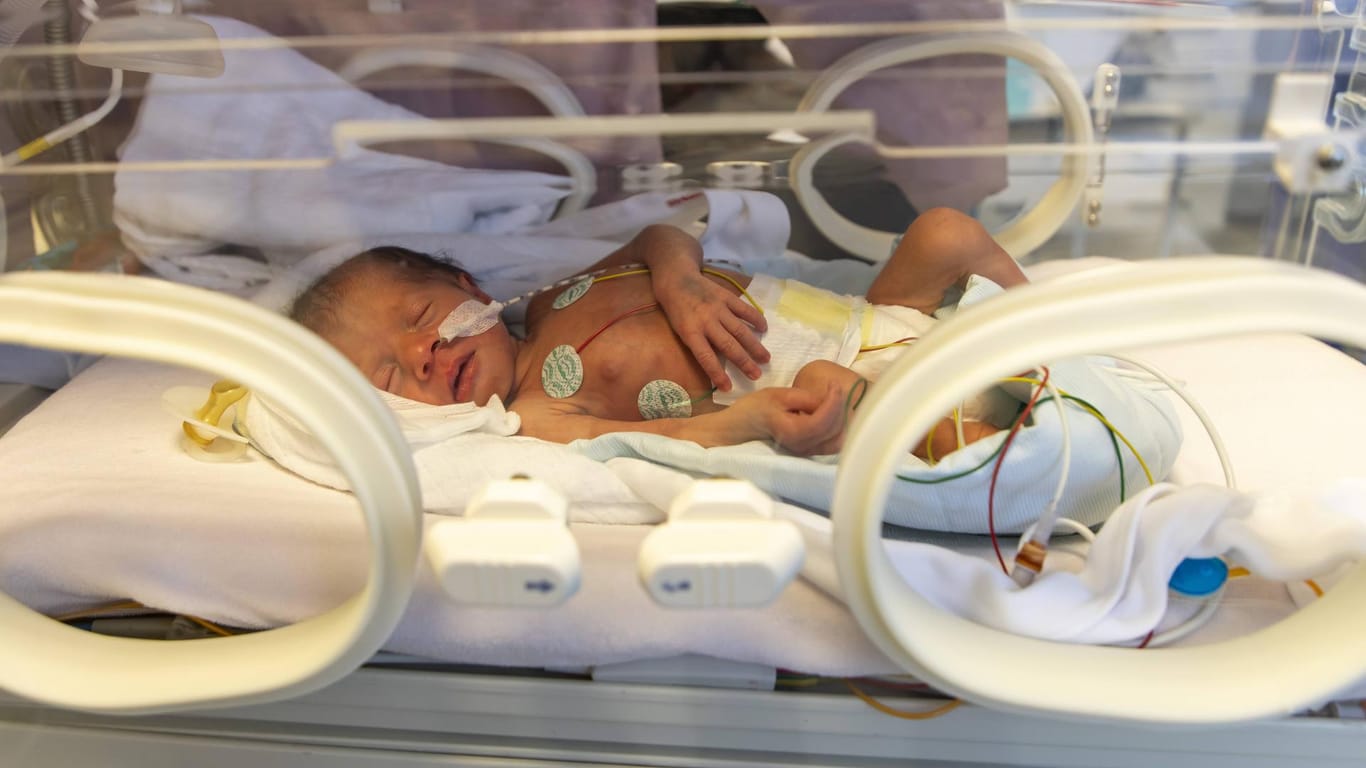 Ein Säugling auf einer Frühgeborenenstation in einem Krankenhaus: In Deutschland werden deutlich mehr Kinder zu früh geboren als in anderen EU-Ländern.