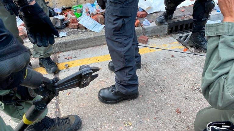 Dieses vom Hong Kong Police Department zur Verfügung gestellte Foto zeigt einen Pfeil in der Wade eines Polizisten. Das Geschoss soll von Aktivisten abgefeuert worden sein.