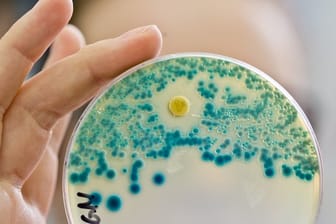 Eine Indikatorkulturplatte zum Nachweis von resistenten Bakterien.