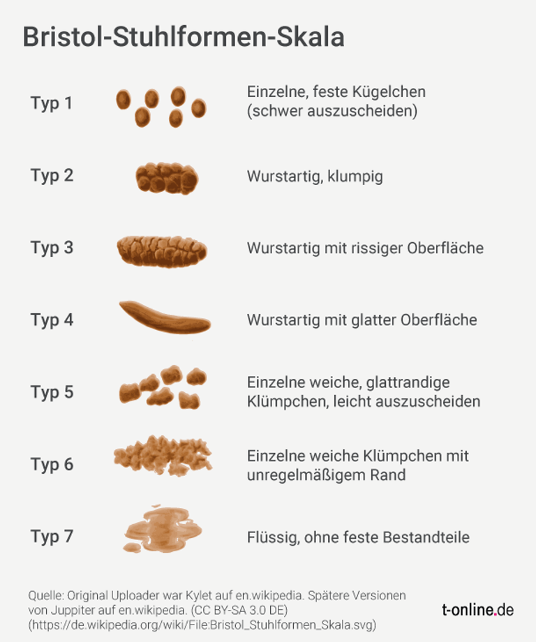 Wie Oft Sollte Man Stuhlgang Haben? Das Sollten Sie Wissen