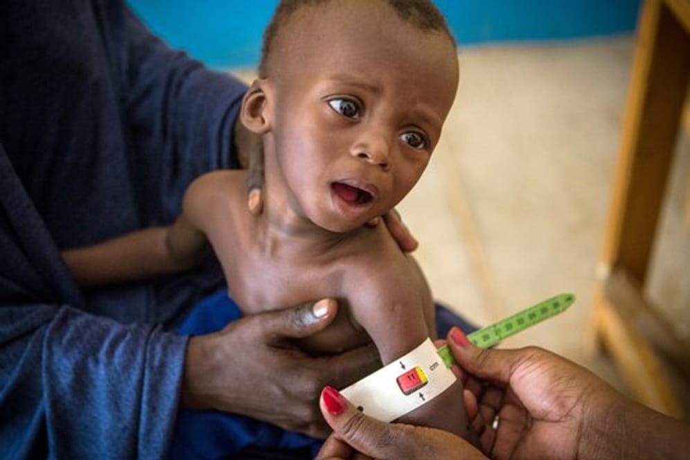 Im Gesundheitszentrum von Gao (Mali) wird der arm eines schwer unterernährten, 16 Monate alten Kindes vermessen.