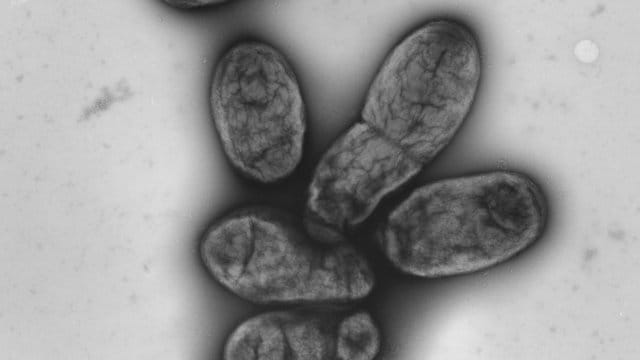 Eine elektronenmikroskopische Aufnahme zeigt das Pestbakterium Yersinia pestis.