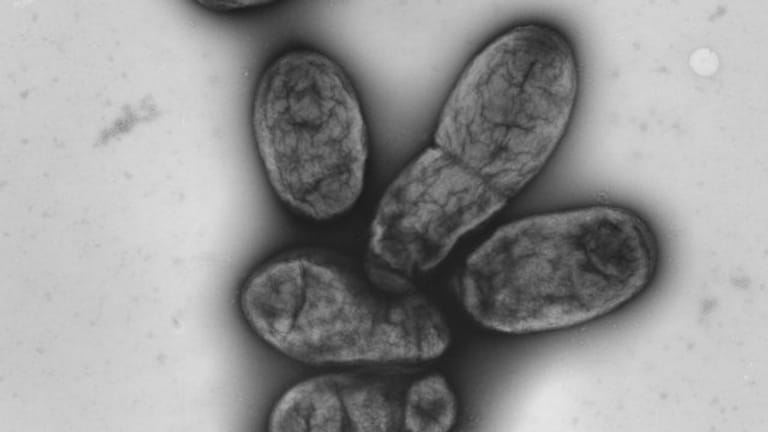 Eine elektronenmikroskopische Aufnahme zeigt das Pestbakterium Yersinia pestis.