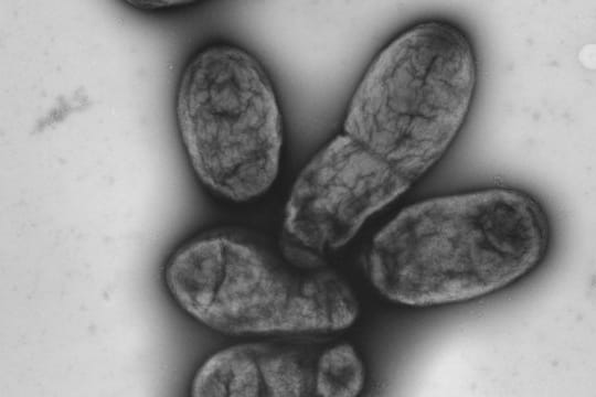 Eine elektronenmikroskopische Aufnahme zeigt das Pestbakterium Yersinia pestis.