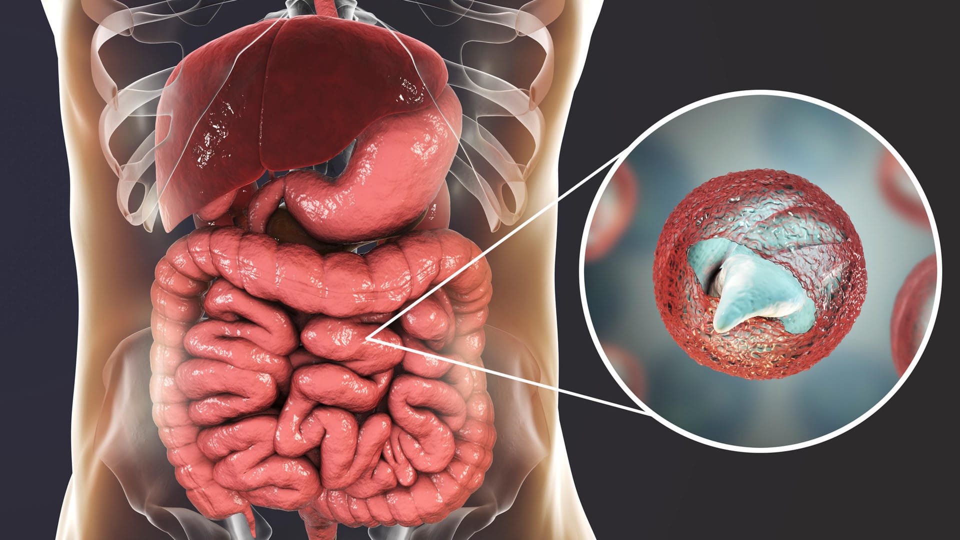 Darstellung eines Cryptosporidium Parvum im Magen-Darm-Trakt: Die Parasiten verursachen grippeähnliche Symptome wie Durchfall und Fieber.