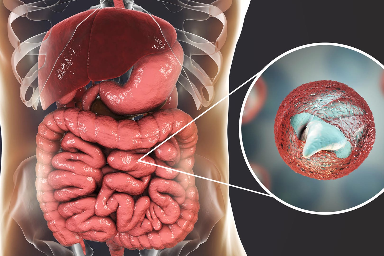 Darstellung eines Cryptosporidium Parvum im Magen-Darm-Trakt: Die Parasiten verursachen grippeähnliche Symptome wie Durchfall und Fieber.