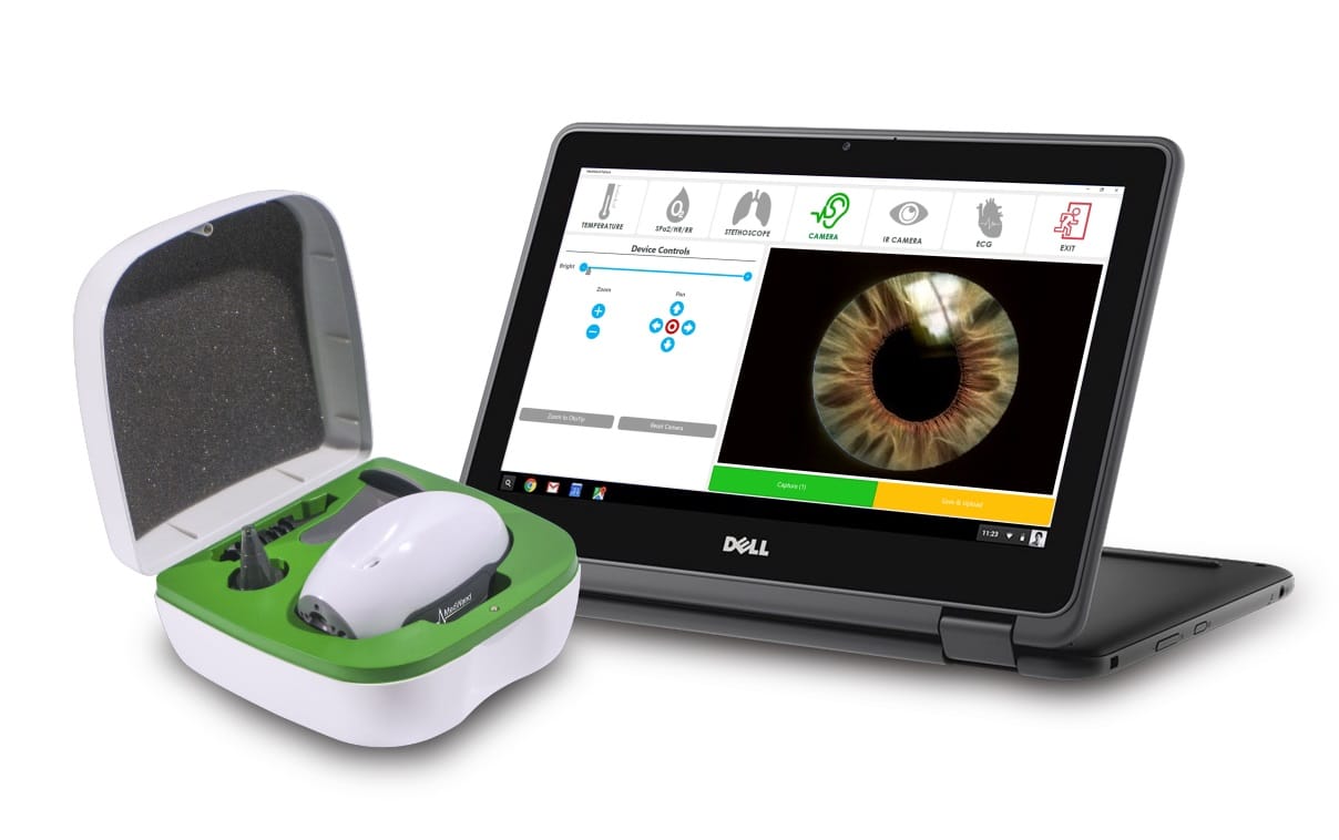 MedWand ist ein kleines Gerät, das bessere Ferndiagnosen erlaubt
