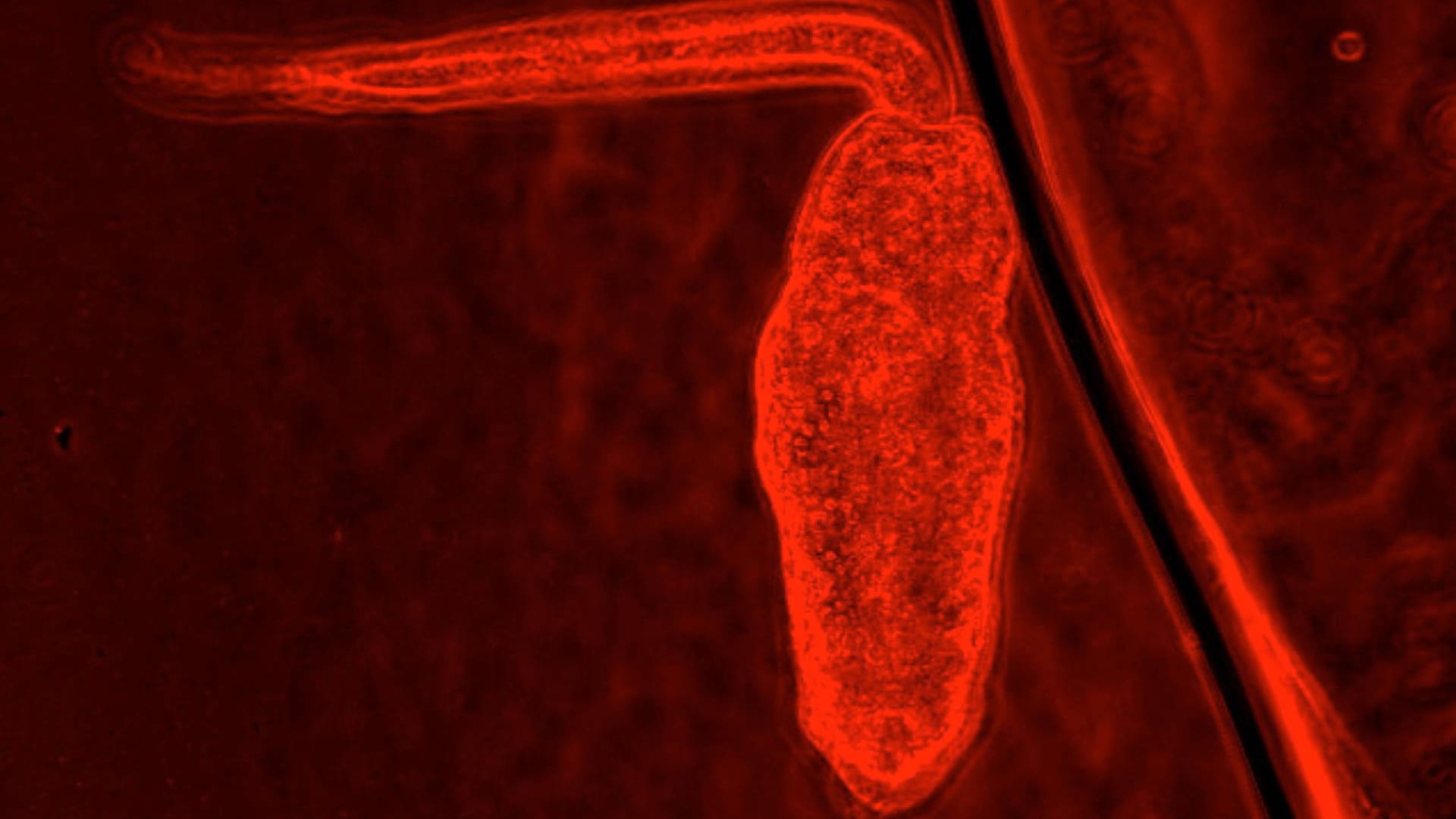 Saugwurm auf einer undatierten Aufnahme der Penn-State-Universität: Die Parasiten nisten sich zunächst in Algen, dann in Schildkröten ein.