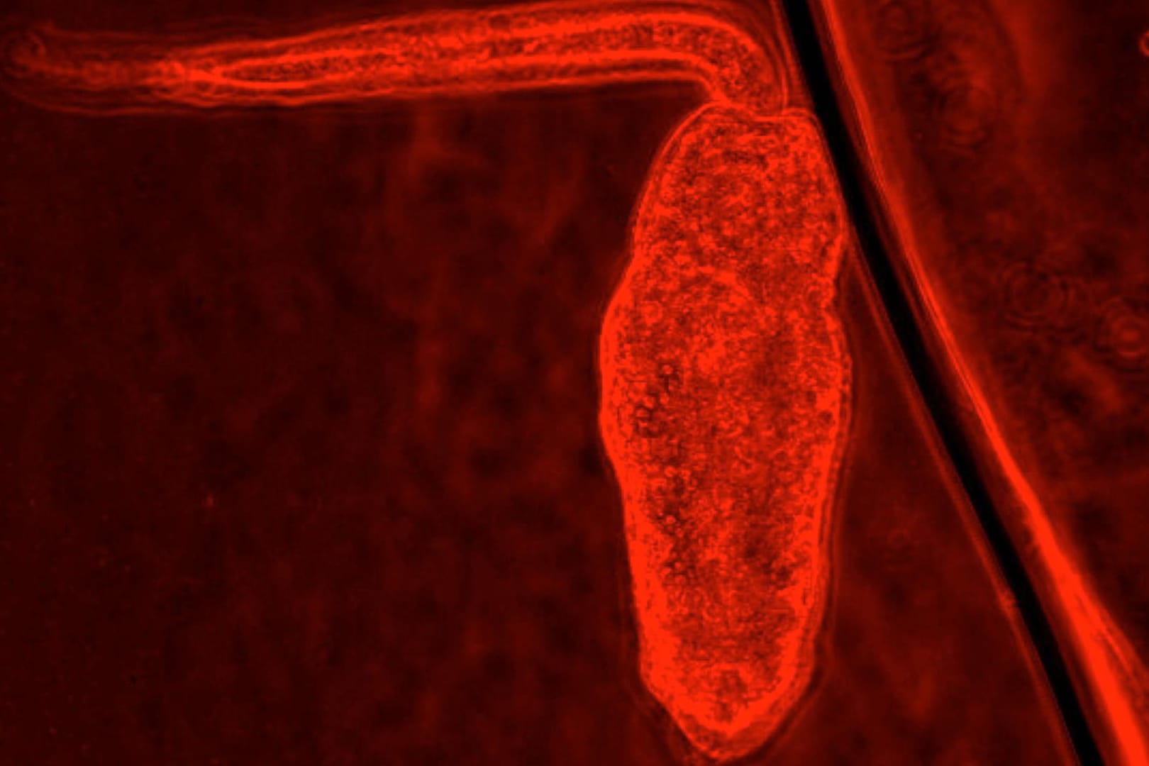 Saugwurm auf einer undatierten Aufnahme der Penn-State-Universität: Die Parasiten nisten sich zunächst in Algen, dann in Schildkröten ein.