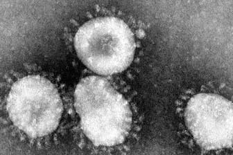 Ein Coronavirus unter einem Mikroskop.