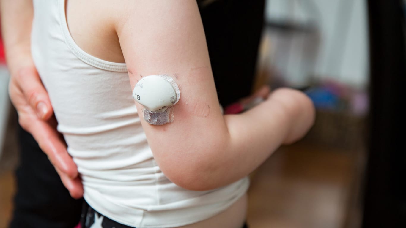 Über einen am Arm befestigen Sensor, lässt sich der Gewebezucker kontinuierlich messen. Das so genannte CGM-System ist vor allem für Diabetiker mit starken Blutzuckerschwankungen geeignet.