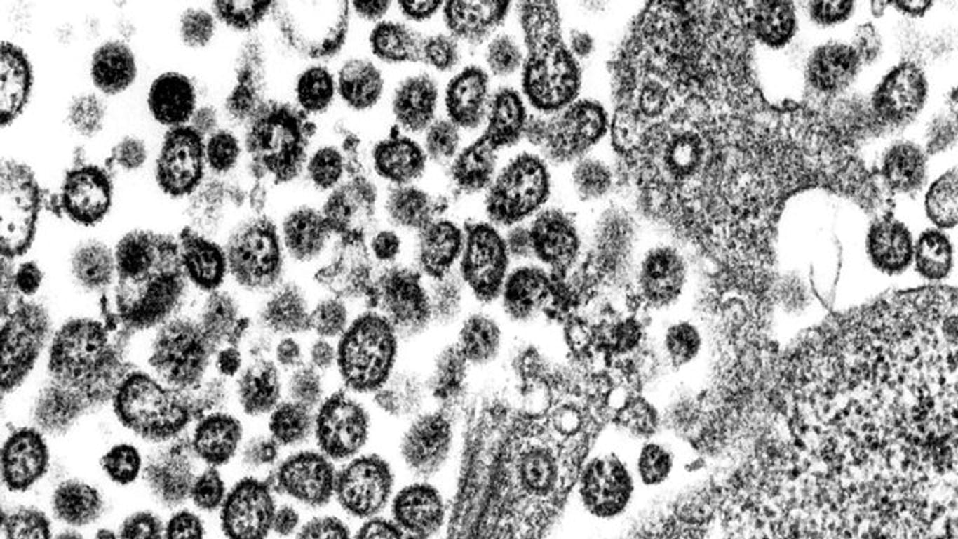 Das Lassavirus unter einem Elektronenmikroskop.