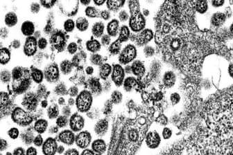 Das Lassavirus unter einem Elektronenmikroskop.
