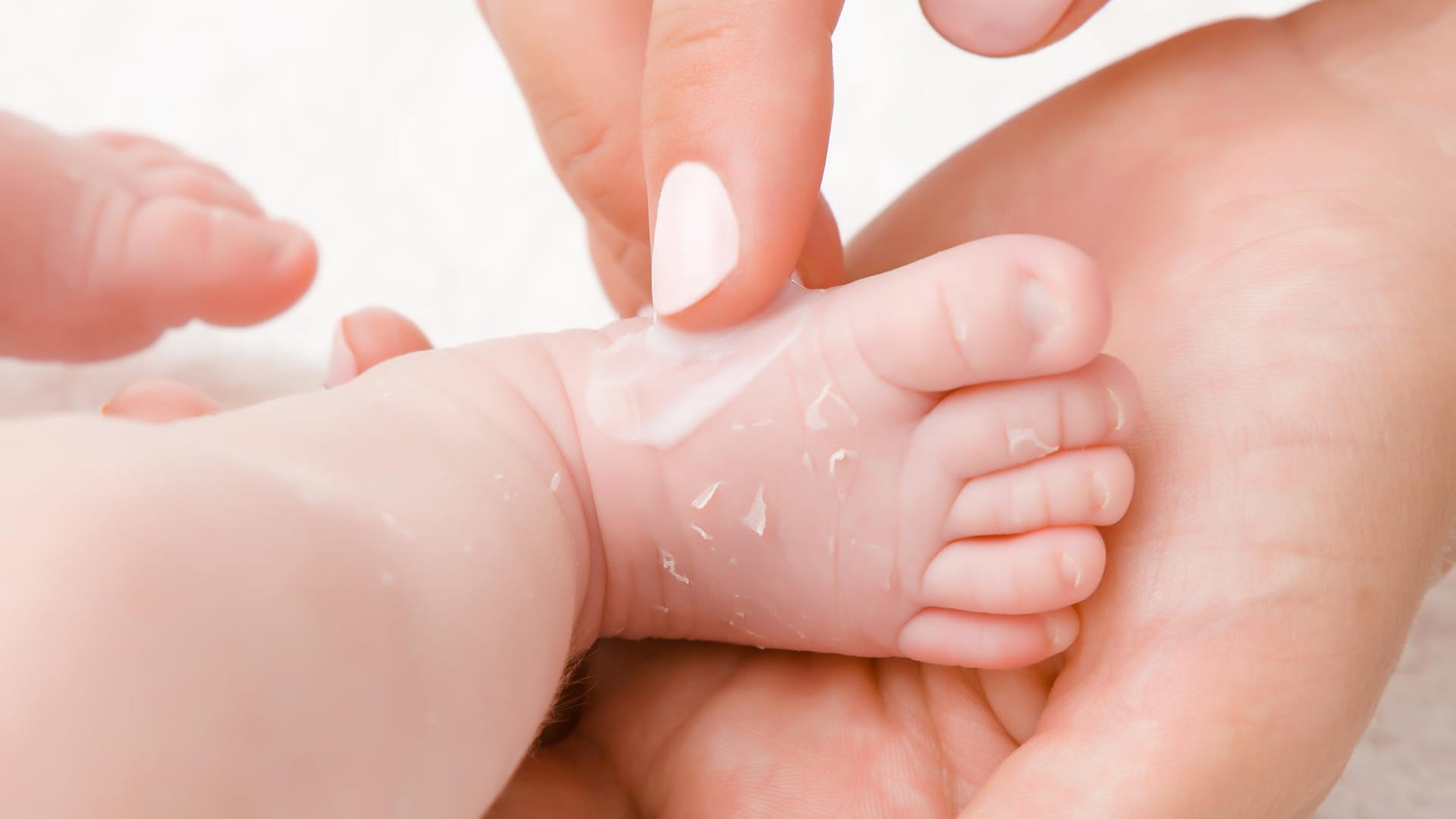 Babylotion: In einer Sorte von dm könnten Hefen enthalten sein.