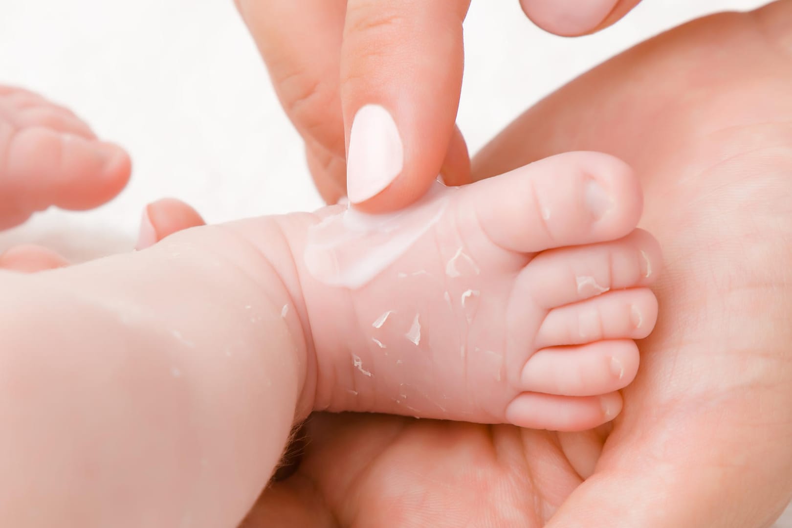 Babylotion: In einer Sorte von dm könnten Hefen enthalten sein.