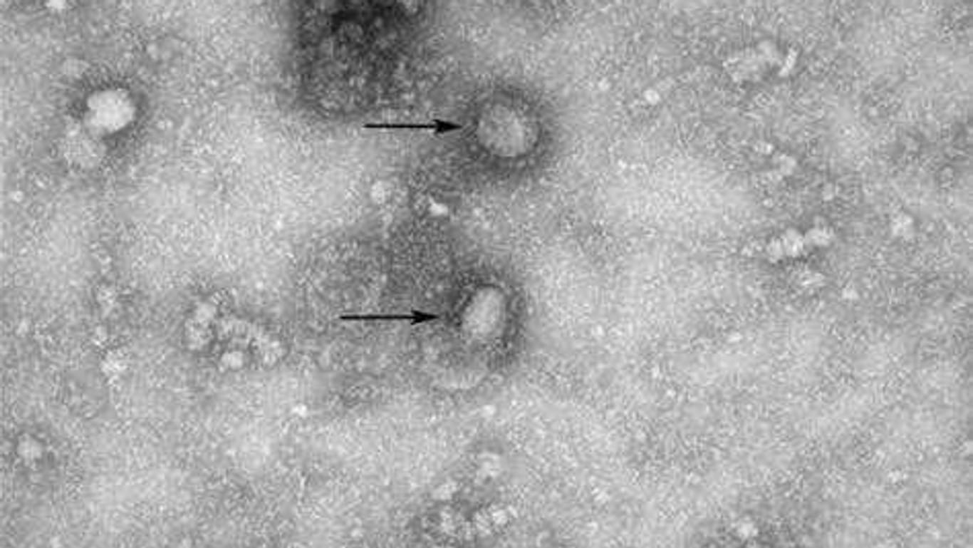 Das neue Coronavirus unter dem Elektronenmikroskop.