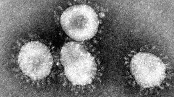 Coronavirus unter dem Mikroskop.