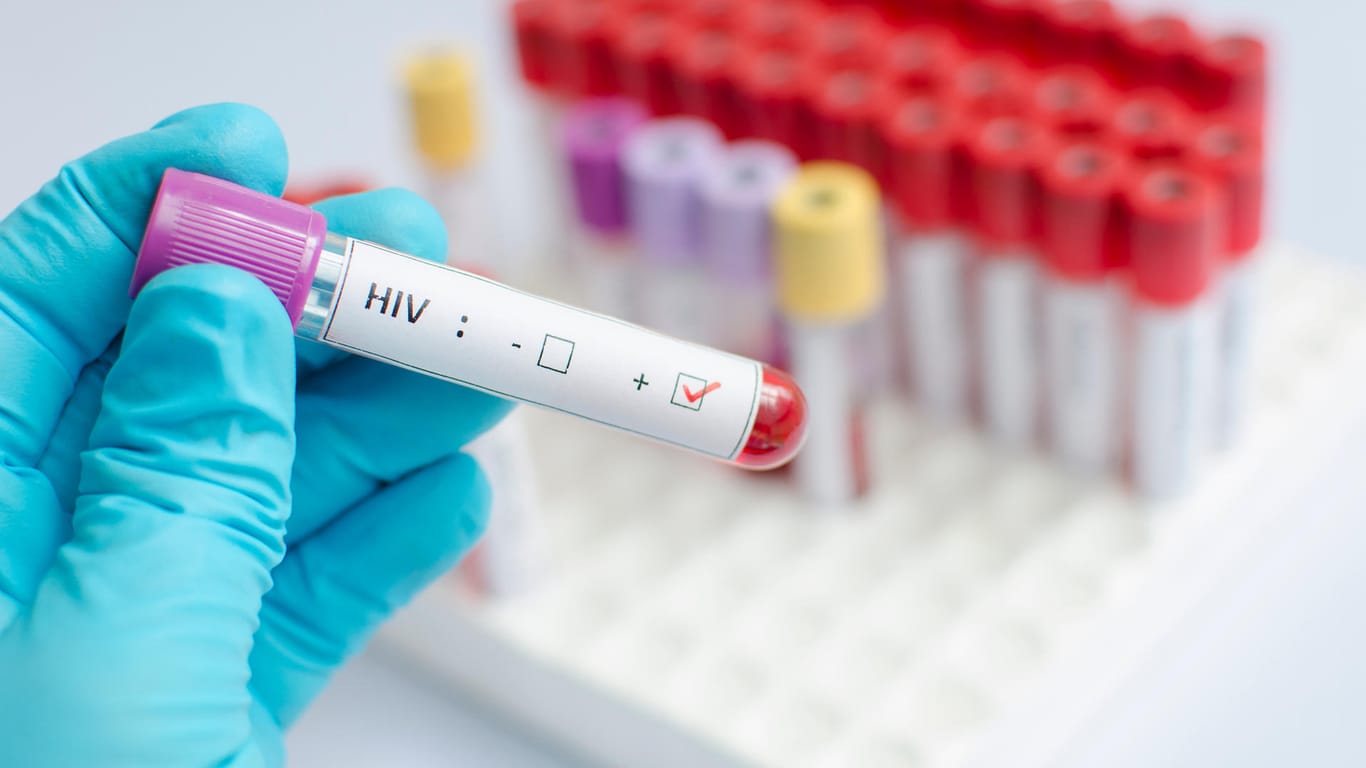 HIV-Impfstoff: Insgesamt hatten an der Studie rund 5.400 HIV-negative Südafrikaner teilgenommen.