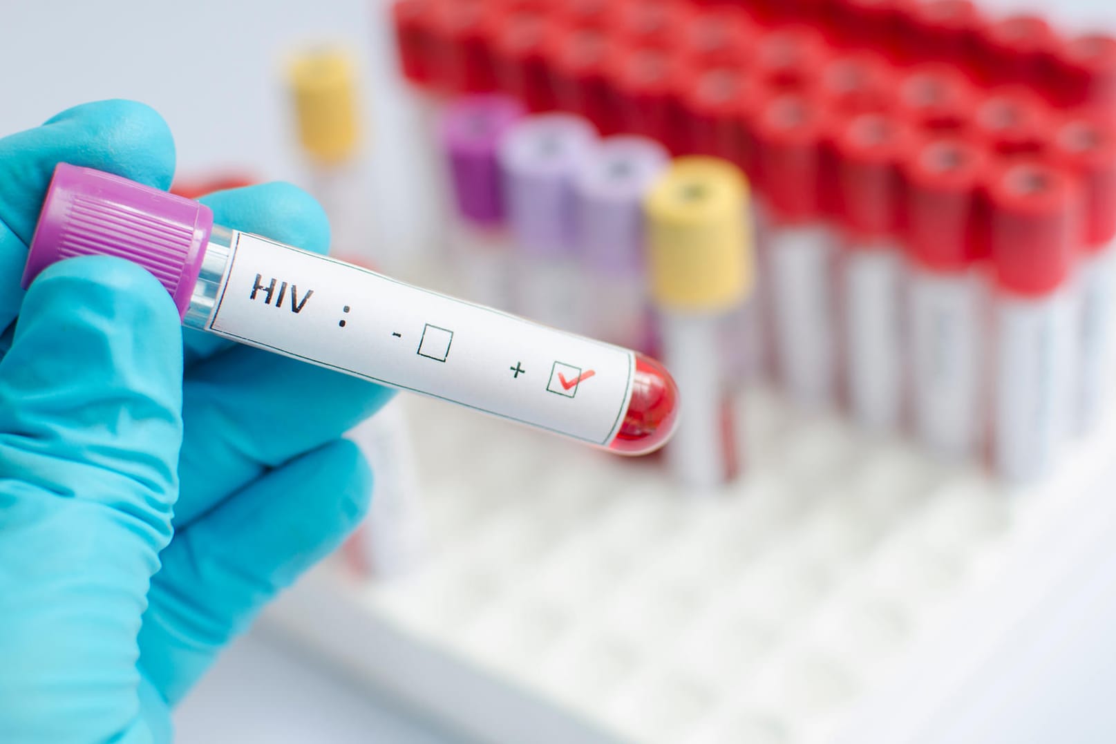 HIV-Impfstoff: Insgesamt hatten an der Studie rund 5.400 HIV-negative Südafrikaner teilgenommen.