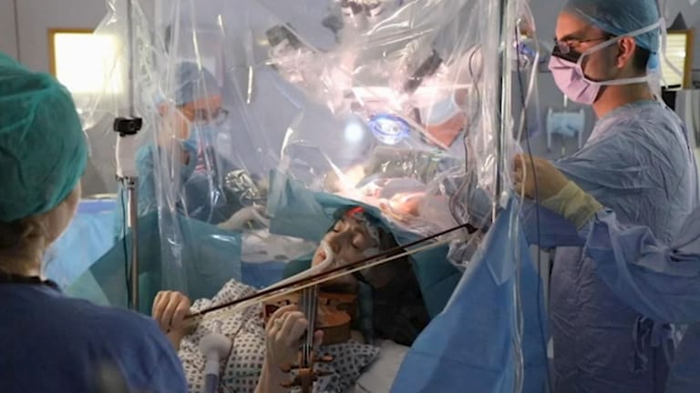 Bei Hirn-OP: Die Ärzte ließen die Patientin während der Operation auf ihrer Violine spielen.