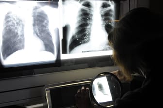 Dr. Gisela Glaser-Paschke, Leiterin der Zentrale für Tuberkulosebekämpfung: An einer Berliner Grundschule gibt es einen Tuberkulose-Fall.
