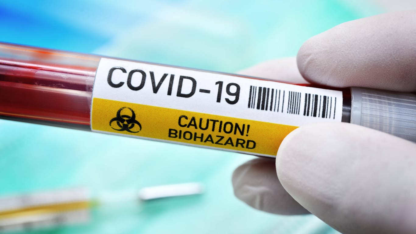 Blutentnahmeröhrchen mit der Aufschrift "Covid-19. Caution! Biohazard": In Essen ist die erste Coronavirus-Infektion nachgewiesen worden.
