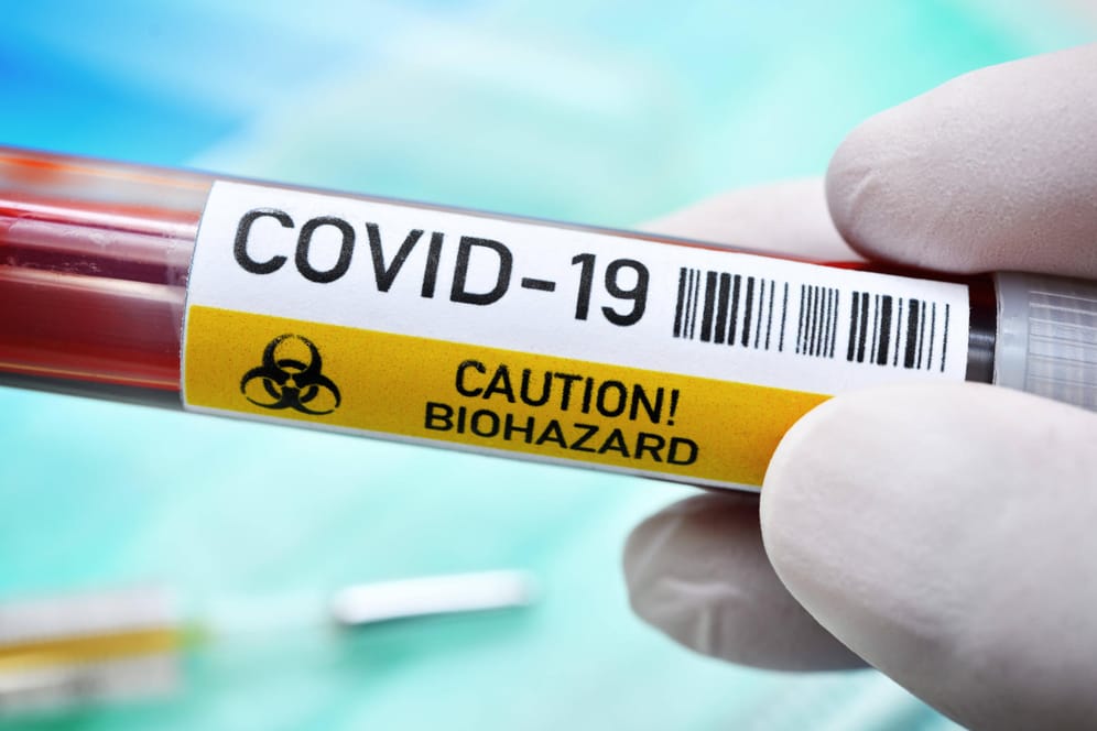 Blutentnahmeröhrchen mit der Aufschrift "Covid-19. Caution! Biohazard": In Essen ist die erste Coronavirus-Infektion nachgewiesen worden.